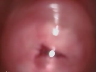 Syvän anaali likainen video- kanssa karvainen kiinalainen ominaisuus