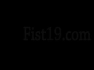 Drei first-rate hände im prolapsed anal