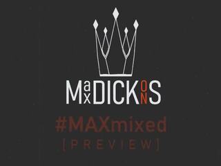 Max dickons - eccentrico misto compilazione, hd x nominale video b3