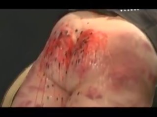Extraordinary doc pours elite wax all over her big spanked