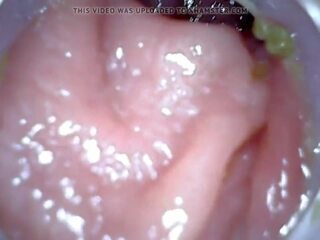 Silit endoscope part 1, free enema punishment dhuwur definisi xxx clip 04
